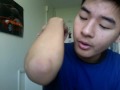 Elbow Zit Elbow Zit